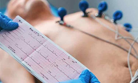 Mawab rolls out free ECG tests