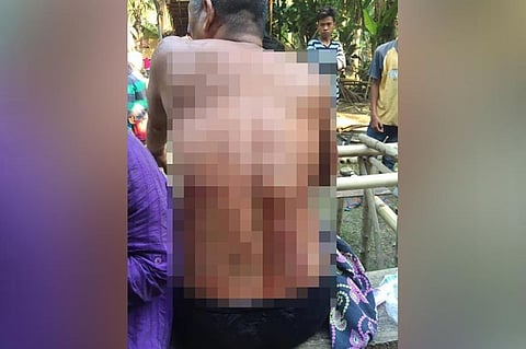 DAVAO. Ang usa sa mga naigo sa mga tipaka sa bomba sa pagbusikad niadtong kaadlawon sa Abril 12, 2020 didto sa probinsiya sa Maguindanao diin unom ang nasamdan. (Hulagway ni Edgardo E. Fuerzas)