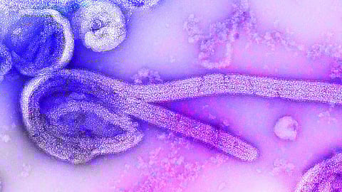 The Crimean Congo Hemorrhagic Fever (CCHF), commonly termed as the Congo fever, spreads in humans via ticks.