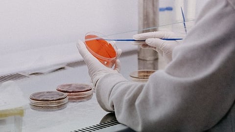 Representative image