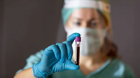 In plasma therapy, antibodies from the blood of a patient who has recovered from the COVID are used to treat patients