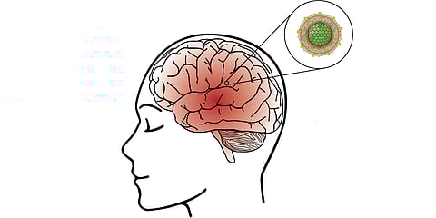 Image for representational purpose