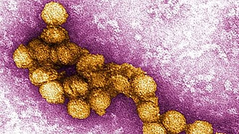 West Nile Virus Micrograph
