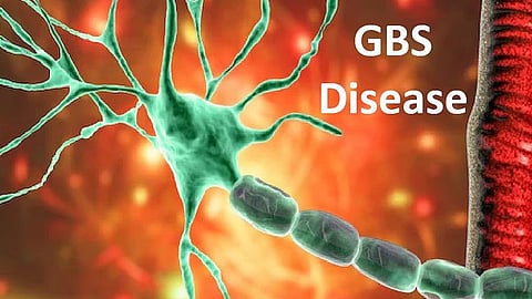 Guillain-Barre Syndrome Cases