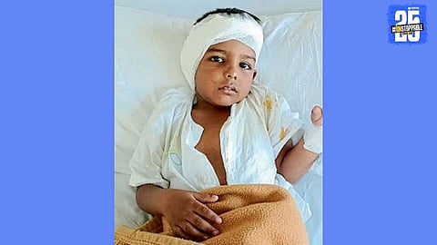 4-Year-Old Boy Hears for the First Time After Free Cochlear Implant Surgery