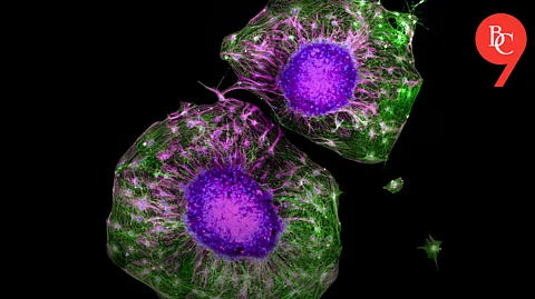 MIT Engineers Discover Exercise Promotes Nerve Growth; Here's What You Should Know