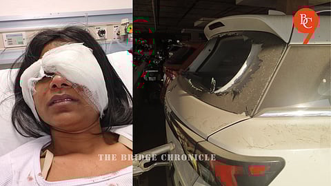Pune Road Rage Turns Brutal: 28-Year-Old Woman Injured, Car vandalised