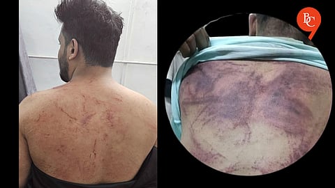 Mob Attacks 14 Men from Kondhwa During Ramzan Iftar Near Bopdev Ghat; 100–150 Booked