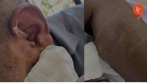 Pune Crime: Dispute During Ram Navami Procession Turn Violent; Youth Injured in Blade Attack