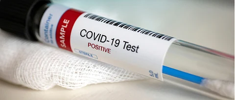 Coronavirus Pune: 9 employees of APMC test positive