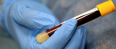 Maharashtra COVID-19 fatalities cross 9000, new cases drop but outstrip Turkey