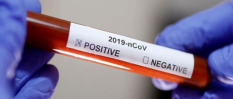 Four employees at Sharad Pawar's Baramati residence Govind Baug test positive for COVID-19