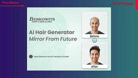 Berkowits Unveils India’s First AI-Powered Hair Transformation Tool