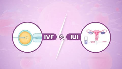 IVF vs IUI: Which Fertility Treatment Is Right for You?