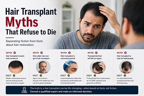 Hair Transplant Myths That Refuse to Die