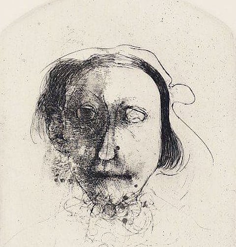 Can Burn Survivors be covered under The Rights of Persons with Disabilities Act, 2016?