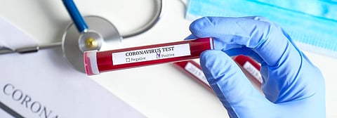 Supreme Court modifies free testing order; says free COVID-19 testing only for economically weaker sections