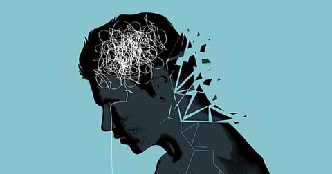 Representative Image Only