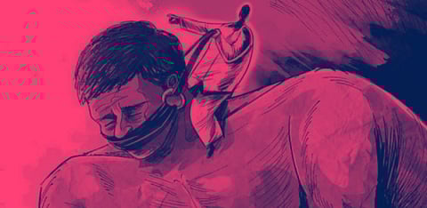 Representative Image Only