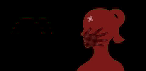 Representative Image Only