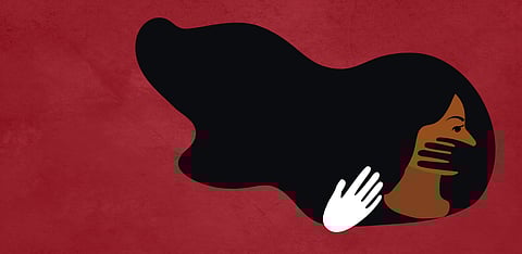 Representative Image Only