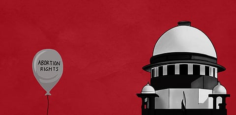 Representative Image Only