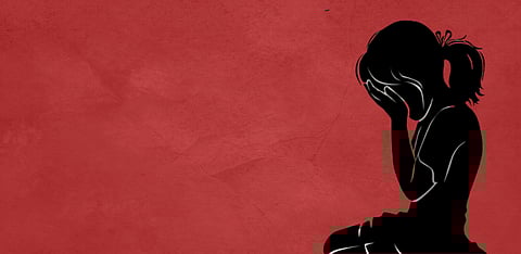 Representative Image Only