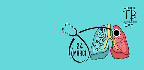 Representative Image Only