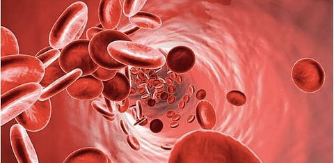 Representative Image Only