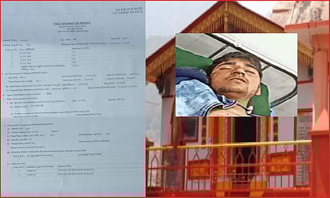 उत्तराखंड: मन्दिर में प्रवेश करने पर दलित युवक की पिटाई, हाथ-पीठ और कूल्हे को दागा