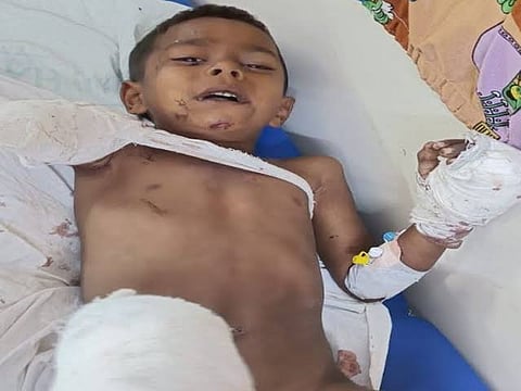 मध्य प्रदेश: ट्रेन की चपेट में आए मासूम को परिजनों को नहीं सौंपेगी बाल कल्याण समिति!