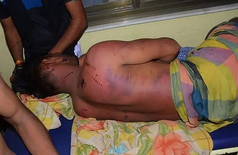 राजस्थान: पत्तल उठाने के लिए बुलाया, गुप्तागों में पेट्रोल-नींबू-मिर्च डालकर की मारपीट