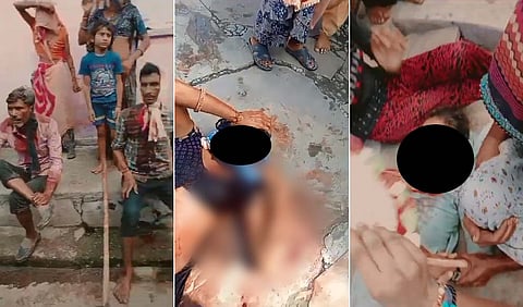 गोलीकांड में घायल आदिवासी परिवार के लोग