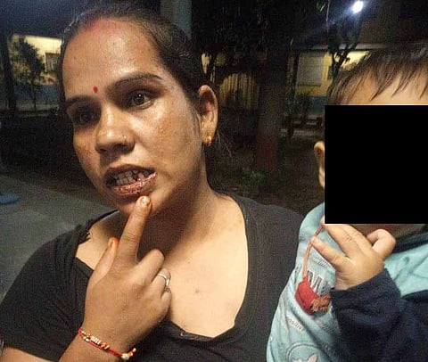 राजस्थान में बच्चा पड़ोसी के कमरे के सामने गया तो मां की पिटाई. पीड़ित महिला