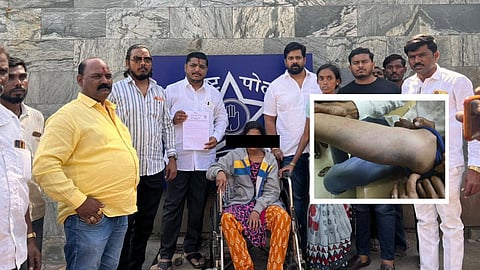 महराष्ट्र: पुलिस चौकी में आदिवासी महिला के साथ बर्बरता, पिटाई से हाथ-पैर काले पड़े