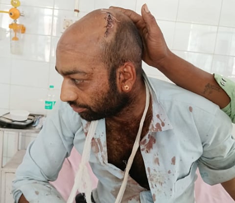 Rajasthan: पट्टेशुदा जमीन पर कब्जा करने के लिए मेघवाल परिवार के 6 सदस्यों पर जानलेवा हमला