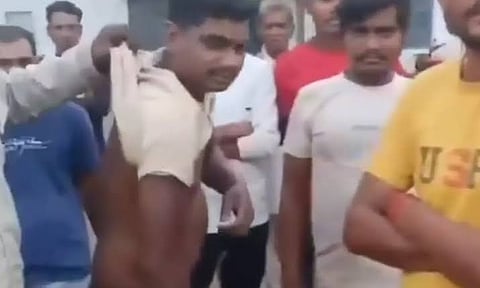 छिंदवाड़ा में आदिवासी युवक से मारपीट, आरोपियों पर पेशाब पिलाने का आरोप