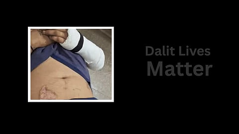 Haryana: Brutality with Dalit youth in police custody, allegation of stick being inserted in private part