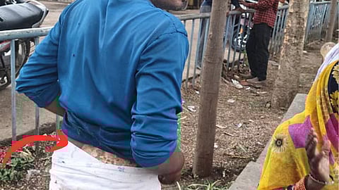 MP: Dalit youth burned alive on a pile of garbage in Sagar! His mother, who came to save him, was also subjected to brutality.