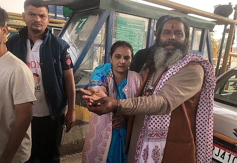 Woman showing hand injury