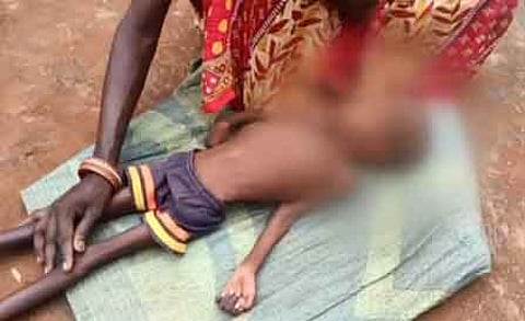 Hunger and malnutrition continue to plague Odisha, despite government initiatives