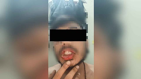 Dalit Student Held Hostage and Subjected to Attempted Sexual Assault in BHU Hostel