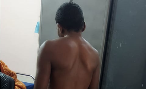 Anil recounts receiving "300-400 lathi blows" in the police station and losing consciousness due to the severe beating.