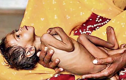 In the Kolu Panchayat of Shyopur district, three children have died in the past month.