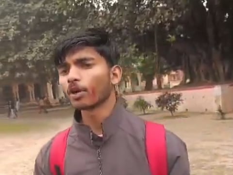 A student named Sanjay recounted that while they were studying on campus, a group suddenly attacked them, causing injuries to many.