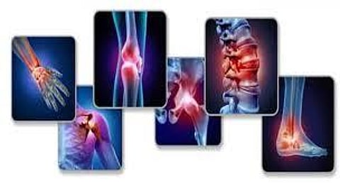 4 अगस्त: बोन एंड ज्वाइंट दिन