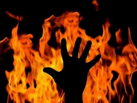 Irked At Unending Domestic Dispute, Man Sets Wife, Mother-in-Law, Self On Fire In Noida