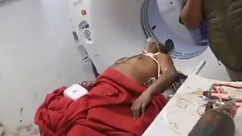 Property Dealer Shot At In Car In Prayagraj, Serious