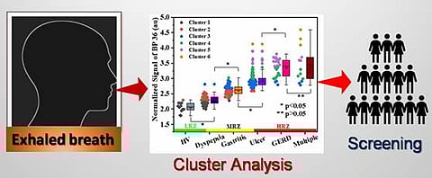 Doctors May Soon Diagnose Peptic Ulcer And Disease Stage By Recognising Breath Patterns