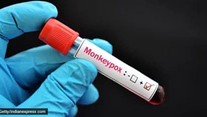 PM Modi Personally Monitoring Situation After WHO Declares Mpox A Public Health Emergency